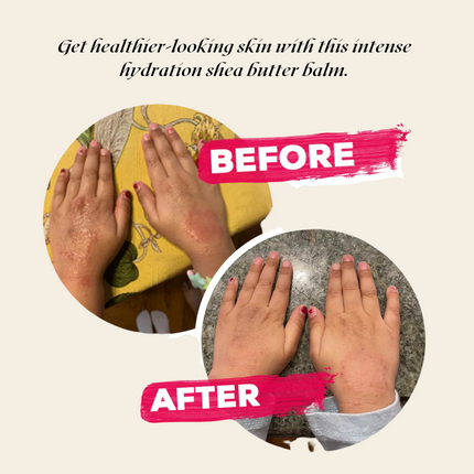 Velvet Hydration Body Balm – Ultra-Rich, Vegan, Gluten-Free Moisture